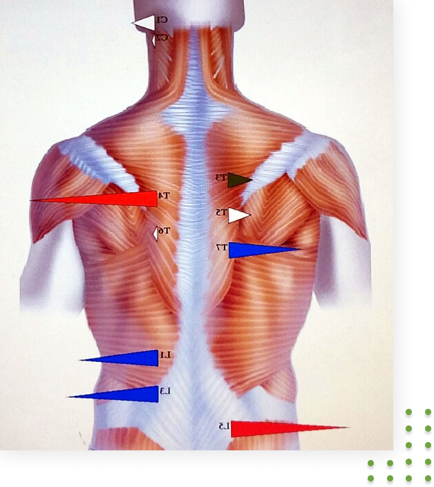 Surface EMG scan showing spinal muscle tension